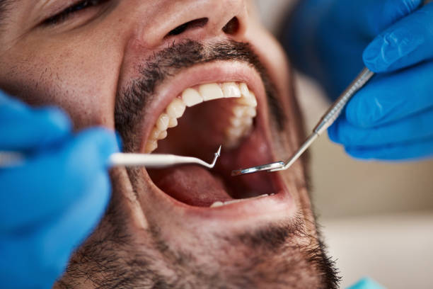 Best Emergency Dental Extractions in Girard, PA