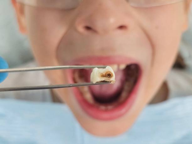 Best Urgent Dental Care for Toothache in Girard, PA